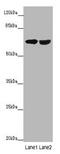 Interferon Induced Protein With Tetratricopeptide Repeats 3 antibody, A55830-100, Epigentek, Western Blot image 
