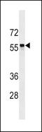 SLC22A2 antibody, LS-C158989, Lifespan Biosciences, Western Blot image 
