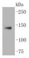 Low Density Lipoprotein Receptor antibody, NBP2-67414, Novus Biologicals, Western Blot image 