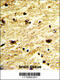 Exosome Component 8 antibody, 61-502, ProSci, Immunohistochemistry paraffin image 