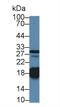 Troponin C, slow skeletal and cardiac muscles antibody, abx131643, Abbexa, Western Blot image 