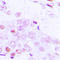 Activating Transcription Factor 2 antibody, LS-C353953, Lifespan Biosciences, Immunohistochemistry frozen image 