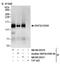 SWI/SNF Related, Matrix Associated, Actin Dependent Regulator Of Chromatin, Subfamily A, Member 5 antibody, NB100-55311, Novus Biologicals, Immunoprecipitation image 