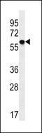 Transmembrane 9 superfamily member 2 antibody, LS-B12359, Lifespan Biosciences, Western Blot image 