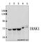Interleukin 1 Receptor Associated Kinase 1 antibody, A01021T381, Boster Biological Technology, Western Blot image 