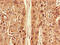 Autophagy Related 7 antibody, A62122-100, Epigentek, Immunohistochemistry paraffin image 