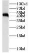 ST8 Alpha-N-Acetyl-Neuraminide Alpha-2,8-Sialyltransferase 1 antibody, FNab08275, FineTest, Western Blot image 