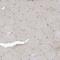 KIF15 antibody, PA5-57305, Invitrogen Antibodies, Immunohistochemistry paraffin image 