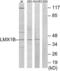 LIM Homeobox Transcription Factor 1 Beta antibody, LS-C118699, Lifespan Biosciences, Western Blot image 