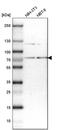 RNA Guanylyltransferase And 5'-Phosphatase antibody, PA5-51999, Invitrogen Antibodies, Western Blot image 