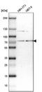 GTase antibody, PA5-51999, Invitrogen Antibodies, Western Blot image 