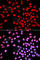 IKAROS Family Zinc Finger 1 antibody, A1850, ABclonal Technology, Immunofluorescence image 