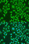 Centromere Protein Q antibody, 23-062, ProSci, Immunofluorescence image 