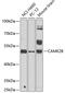 Calcium/Calmodulin Dependent Protein Kinase II Beta antibody, 18-677, ProSci, Western Blot image 