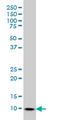 Protein S100-A6 antibody, LS-B5528, Lifespan Biosciences, Western Blot image 