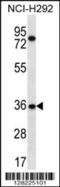 Testis Specific 13 antibody, 56-569, ProSci, Western Blot image 