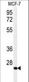 Dehydrogenase/Reductase 2 antibody, LS-C167395, Lifespan Biosciences, Western Blot image 