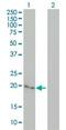 Cytoglobin antibody, ab57713, Abcam, Western Blot image 