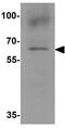 NADPH Oxidase 1 antibody, GTX31929, GeneTex, Western Blot image 