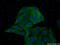 ATP Binding Cassette Subfamily A Member 2 antibody, 20681-1-AP, Proteintech Group, Immunofluorescence image 