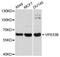 VPS33B Late Endosome And Lysosome Associated antibody, A04628, Boster Biological Technology, Western Blot image 