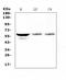 SRY-Box 10 antibody, A00758-1, Boster Biological Technology, Western Blot image 