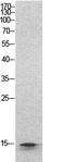 Histone Cluster 1 H2B Family Member B antibody, STJ96866, St John