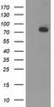 Acyl-CoA Synthetase Short Chain Family Member 2 antibody, TA503609, Origene, Western Blot image 