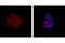 Spleen Associated Tyrosine Kinase antibody, 12081S, Cell Signaling Technology, Immunocytochemistry image 