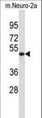 Vesicle Amine Transport 1 Like antibody, LS-C157342, Lifespan Biosciences, Western Blot image 