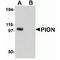 Gamma-Secretase Activating Protein antibody, TA319937, Origene, Western Blot image 