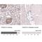 Thrombospondin Type 1 Domain Containing 7A antibody, NBP2-61639, Novus Biologicals, Immunohistochemistry paraffin image 