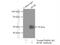 Plasminogen Activator, Urokinase Receptor antibody, 10286-1-AP, Proteintech Group, Immunoprecipitation image 