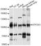 ATPase Sarcoplasmic/Endoplasmic Reticulum Ca2+ Transporting 3 antibody, LS-C749237, Lifespan Biosciences, Western Blot image 