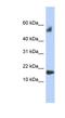 Testis Expressed 19 antibody, NBP1-56811, Novus Biologicals, Western Blot image 