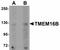Anoctamin 2 antibody, LS-B4615, Lifespan Biosciences, Western Blot image 