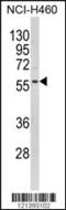 Potassium Voltage-Gated Channel Subfamily J Member 2 antibody, MBS9207156, MyBioSource, Western Blot image 