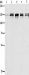 Damage Specific DNA Binding Protein 1 antibody, CSB-PA282824, Cusabio, Western Blot image 