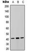 P2Y Receptor Family Member 8 antibody, LS-C368450, Lifespan Biosciences, Western Blot image 