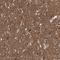 Adenylate Cyclase 2 antibody, NBP1-90281, Novus Biologicals, Immunohistochemistry frozen image 