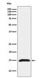 Interferon Induced Transmembrane Protein 3 antibody, M02265, Boster Biological Technology, Western Blot image 