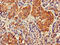 GIT ArfGAP 1 antibody, CSB-PA009439LA01HU, Cusabio, Immunohistochemistry frozen image 