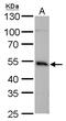 Interferon Regulatory Factor 4 antibody, GTX129135, GeneTex, Western Blot image 