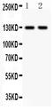 Integrin Subunit Alpha E antibody, PA1622, Boster Biological Technology, Western Blot image 