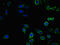 EPH Receptor B2 antibody, orb45834, Biorbyt, Immunocytochemistry image 