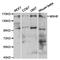 hMSH6 antibody, TA326879, Origene, Western Blot image 