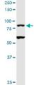 T Cell Activation RhoGTPase Activating Protein antibody, H00117289-D01P, Novus Biologicals, Western Blot image 