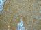 Paxillin antibody, ab32084, Abcam, Immunohistochemistry paraffin image 