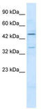 Zinc Finger Protein 358 antibody, TA339503, Origene, Western Blot image 