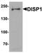 Dispatched RND Transporter Family Member 1 antibody, orb95670, Biorbyt, Western Blot image 
